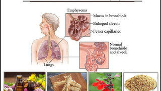 Herbs for Emphysema